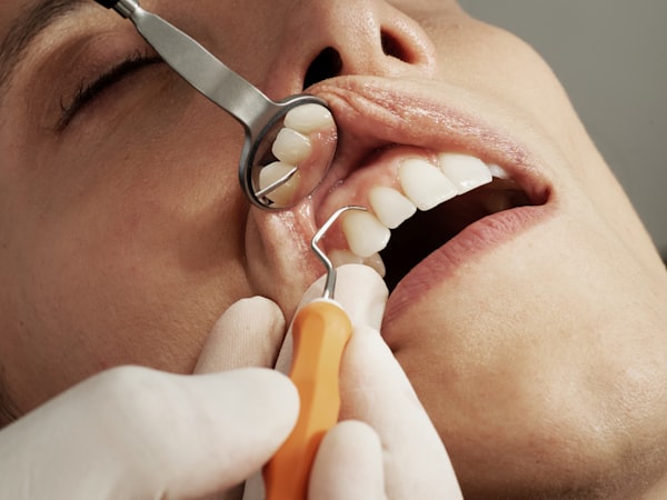 Rehabilitación oral completa con implantes — Después